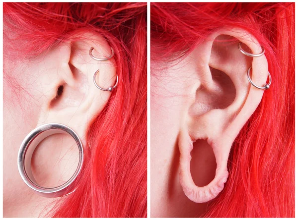 Stretched ear lobe piercing — Stock Photo, Image