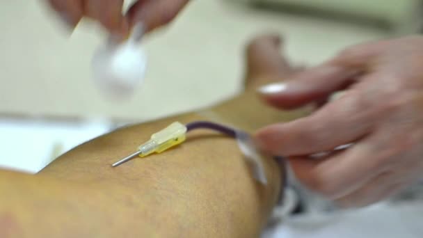 Estrarre l'ago dopo la donazione di sangue . — Video Stock