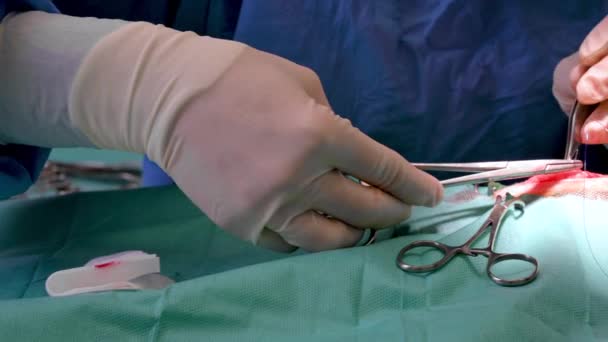 手術だ。手術後に傷を縫い付けた外科医の手を閉じてください。外科的治療の概念.手術器具で手術を行う外科医の手 — ストック動画