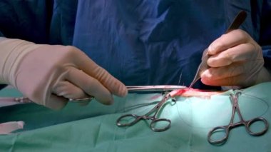 Ameliyat ameliyatı. Cerrah ellerinin ameliyattan sonra yarayı dikmesine yakın durun. Cerrahi tedavi konsepti. Cerrah elleri ameliyat aletleriyle ameliyat yapıyor.