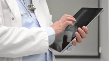 Tanımlanamayan Doktor bilgisayar tabletindeki x-ray görüntülerini kontrol ediyor, kapat. Hastanede çalışan bir doktor. Tıp ve sağlık hizmetleri kavramı