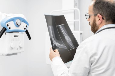 Doktor radyoloji odasındaki hastanın röntgenini inceledi..