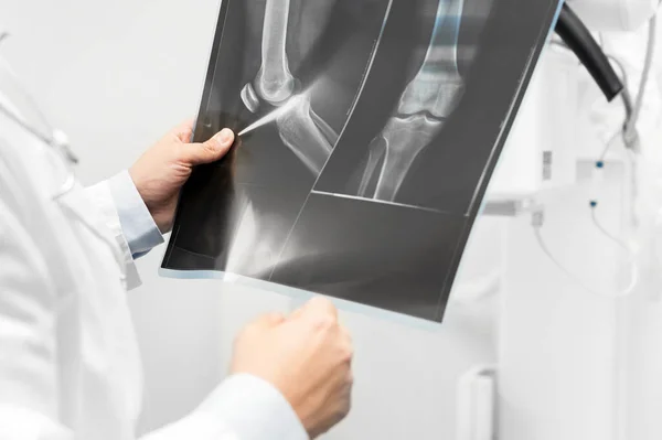 医師は放射線治療室で患者のフィルムX線を調べる. — ストック写真