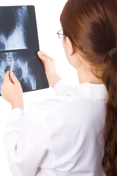 Médecin féminin examinant une radiographie du bassin — Photo