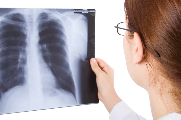 Vrouwelijke arts behandeling een thorax x ray — Stockfoto