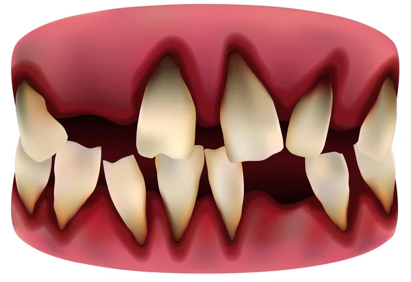 Uma imagem de dente —  Vetores de Stock