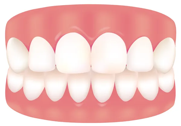 치아의 그림 — 스톡 벡터