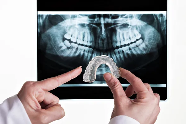 Oplossing tandheelkundige — Stockfoto