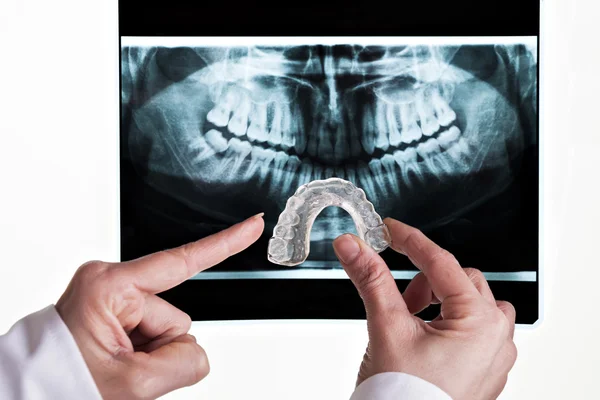 Soluzione dentale — Foto Stock