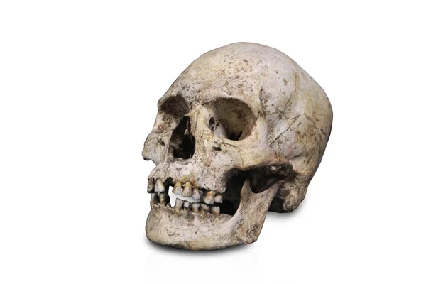 頭蓋骨の分離した人体解剖学 — ストック写真