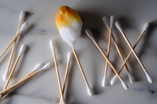 Cleaning Extreme Amount Ear Wax Using Cotton Swabs — Stock Fotó