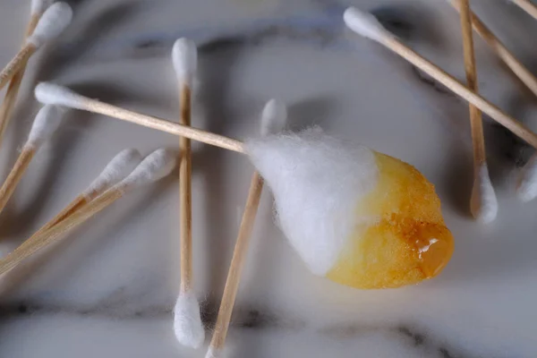 Cleaning Extreme Amount Ear Wax Using Cotton Swabs — Fotografia de Stock