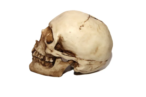 Muerte del cráneo cerebral —  Fotos de Stock