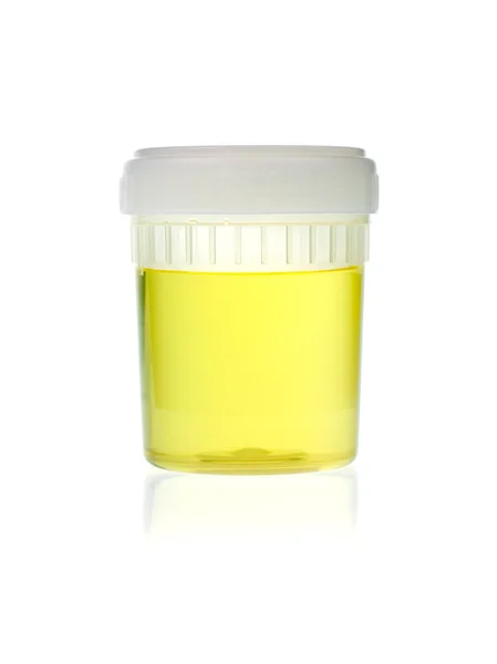 Urine analysis — Stock Photo, Image