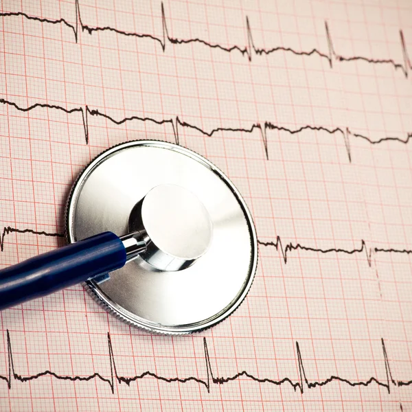 Stetoskop på ekg — Stockfoto