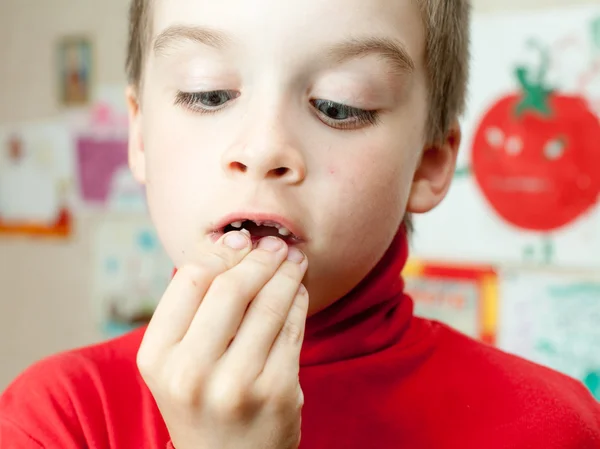 Menino segurando dentes perdidos — Fotografia de Stock
