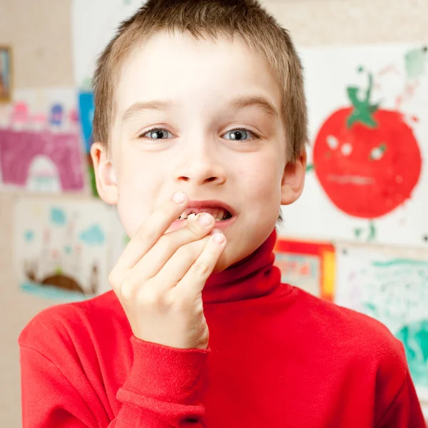Niño con dientes perdidos — Foto de Stock