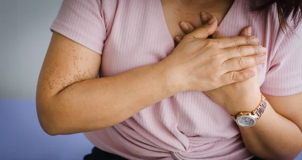 Ongeïdentificeerde Oudere Oude Vrouw Die Bed Zit Lijdt Aan Een — Stockfoto