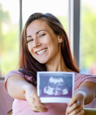 Milenyum Kafkasyalı güzel, neşeli, sağlıklı hamileliğin portresi. Anne gülümsüyor. Elinde ultrason sonogramı olan doğmamış çocuğun röntgen filmini gösteriyor..