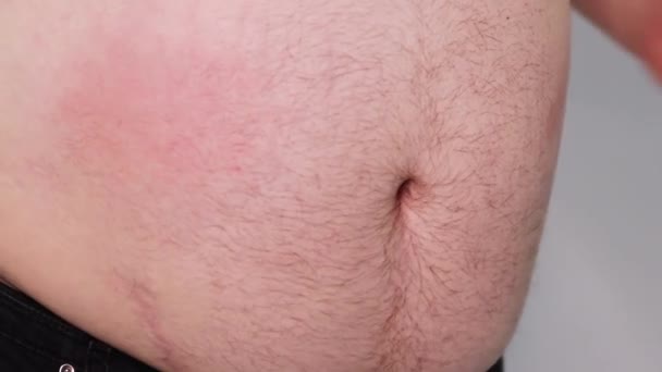 Tlustý Muž Zpomaleně Bije Tleská Rukama Své Holé Velké Břicho — Stock video