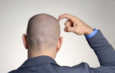 Rear view from a bald head man,thinking and touching his head. clipart