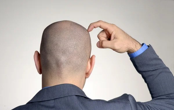 Vista trasera desde un hombre calvo, pensando y tocando su cabeza . — Foto de Stock