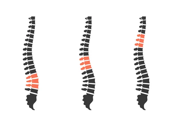 Silhuetas da coluna vertebral humana. dor nas costas isolada no branco — Vetor de Stock