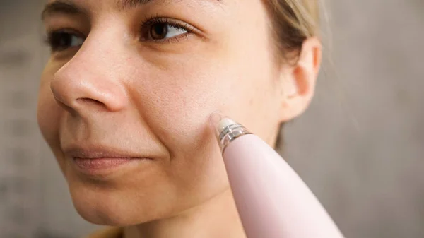 Urządzenie próżniowe do usuwania zaskórników i pryszczy z twarzy — Zdjęcie stockowe