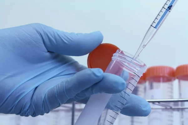 Técnico de laboratorio toma muestra de tubo para prueba — Foto de Stock