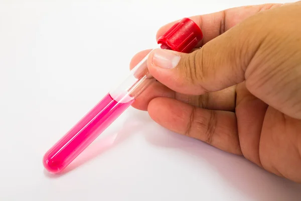 Plastic Test Tube in hand. — Stock Photo, Image