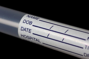 Hastane laboratuar numune etiket