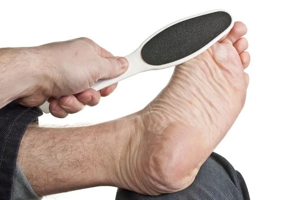Removing callus from toe ball — Stock Photo, Image