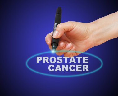 Prostat Kanseri