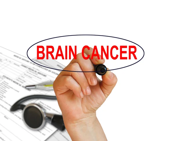 Rak mózgu — Zdjęcie stockowe