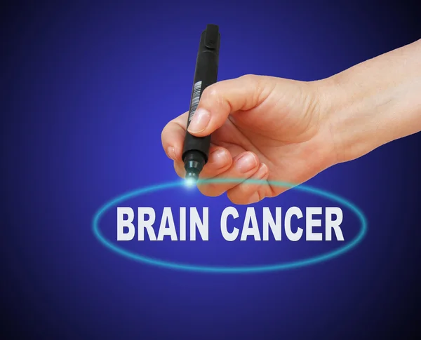 BRAIN CANCER — Stock Photo, Image