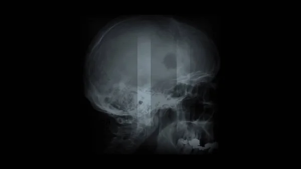 Иллюстрация Рентгеновские Панели Черном Фоне — стоковое фото