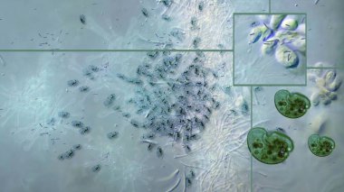 3D illüstrasyon - Mikroskop altında virüsler. Bakteri virüsü 