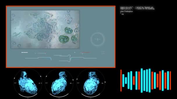アニメーション 顕微鏡下のウイルス 細菌ウイルス — ストック動画