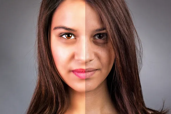 Rostro de hermosa joven antes y después del retoque — Foto de Stock