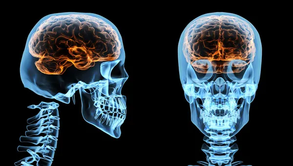 Brain inside skull — Stock Photo, Image