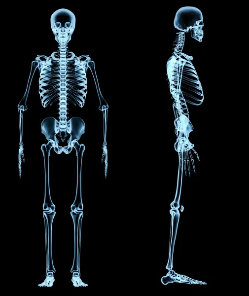 Menselijk skelet onder de x-stralen Rechtenvrije Stockfoto's