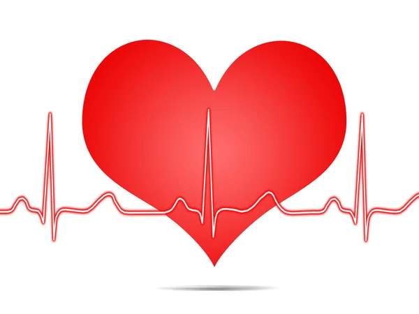 Electrocardiogram, ecg, graph, pulse tracing — Stock Photo, Image