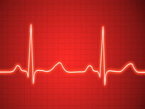Elektrocardiogram, ecg, grafiek, pulse traceren — Stockfoto