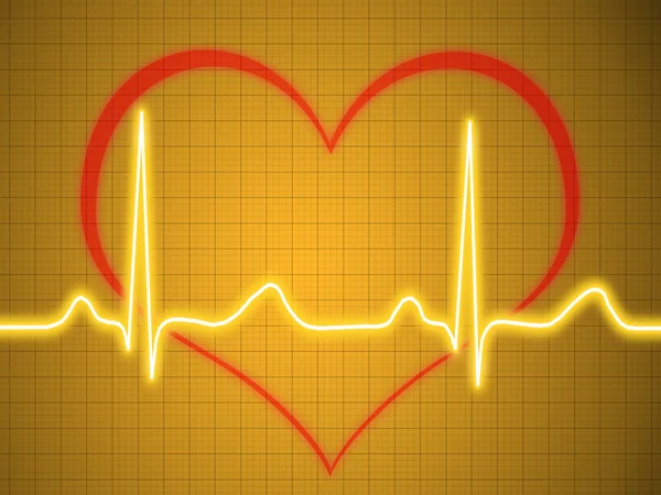 EKG, EKG, grafikon, pulzus követés — Stock Fotó