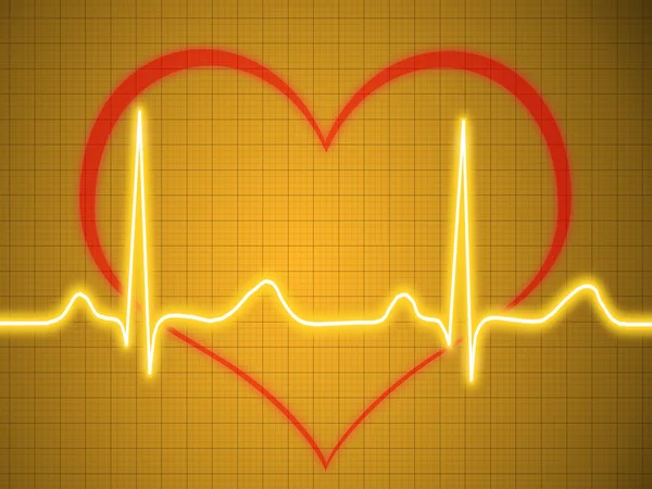 Électrocardiogramme, ecg, graphique, traçage d'impulsions — Photo