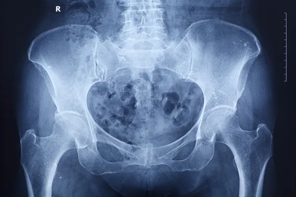 X - ray της σπονδυλικής στήλης και της πυέλου — Φωτογραφία Αρχείου