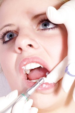 Kozmetik Diş Temizleme