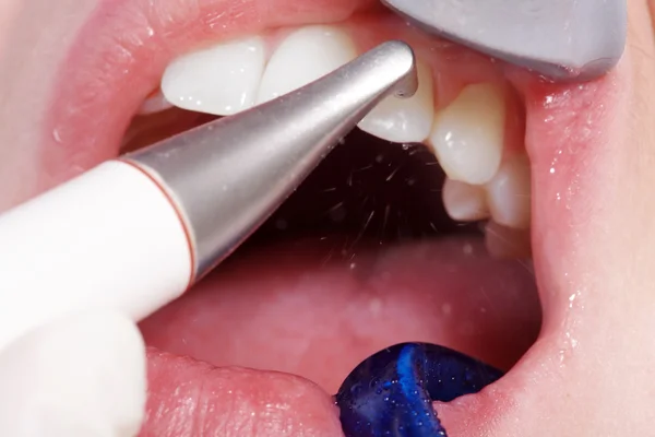 सौंदर्यप्रसाधन दंत स्वच्छता — स्टॉक फोटो, इमेज