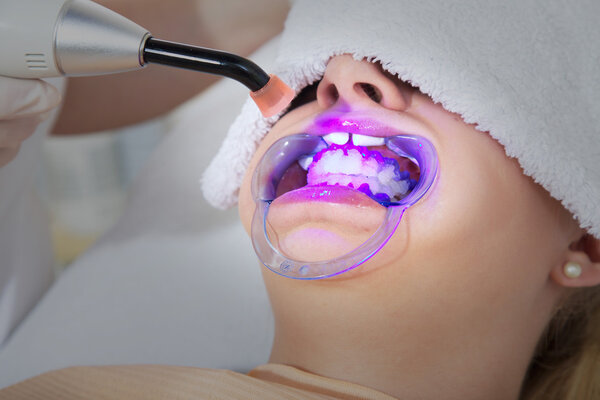 Cosmetic dental cleaning