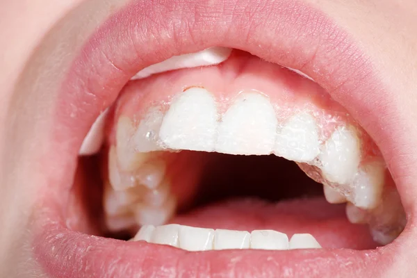 Hermosa boca femenina con dientes blancos — Foto de Stock